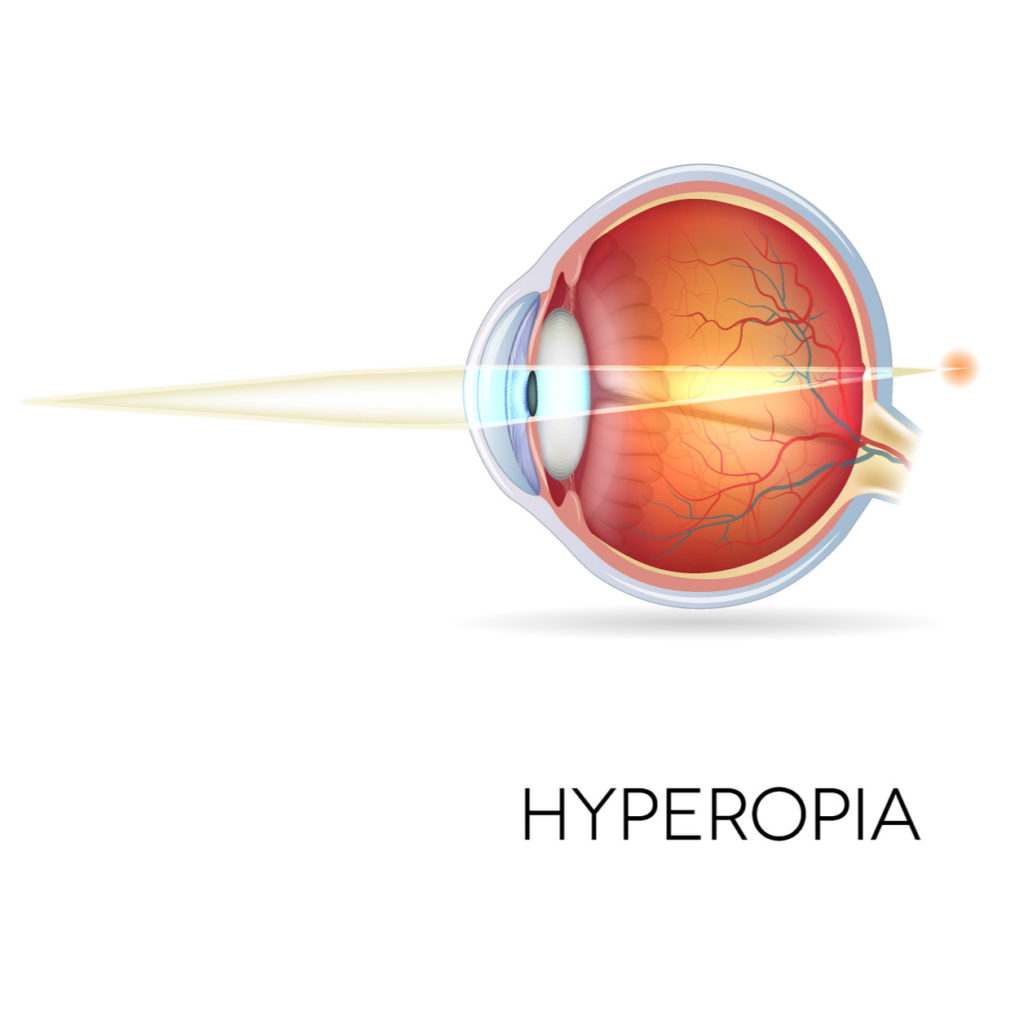 hyperopia or long-sight eyesight diagram