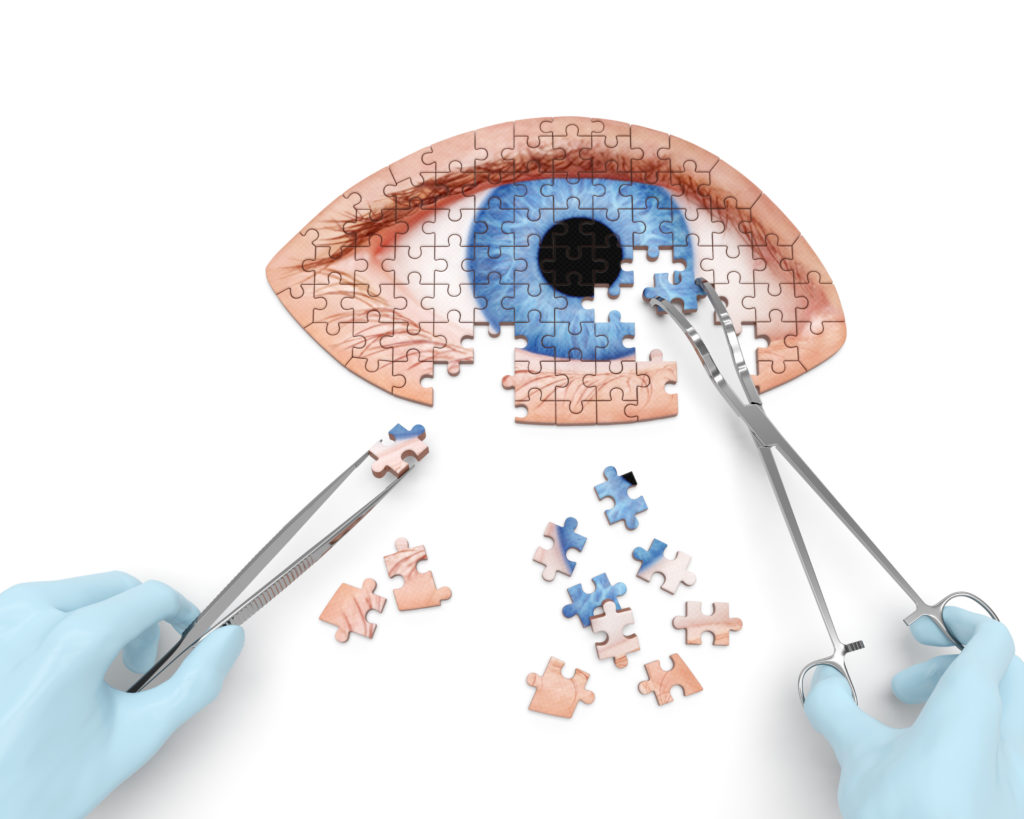 Eye operation (vision correction) puzzle concept: hands of surgeon with surgical instruments (tools) performs eye (ocular) surgery