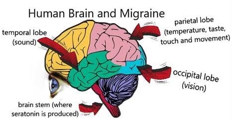 Human brain areas affected by migraines